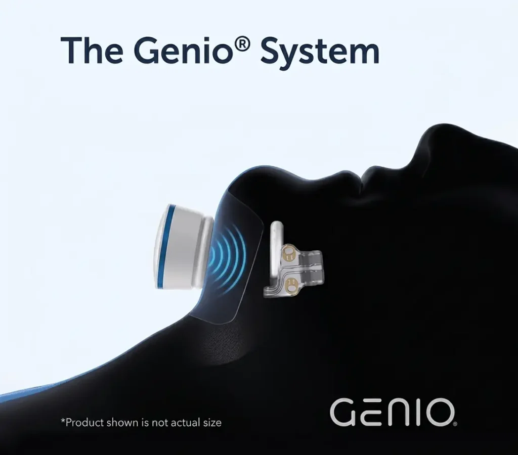 The Genio System 2