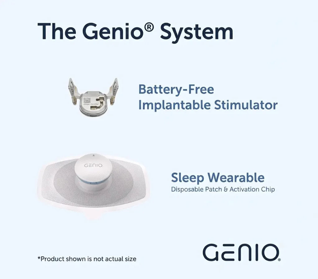 The Genio System